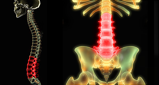 Πότε είναι ανησυχητική η Οσφυαλγία