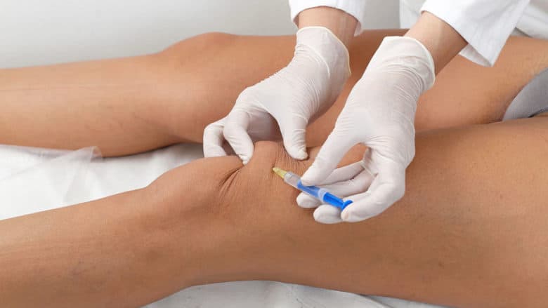 Τι είναι η Προλοθεραπεία (Prolotherapy);